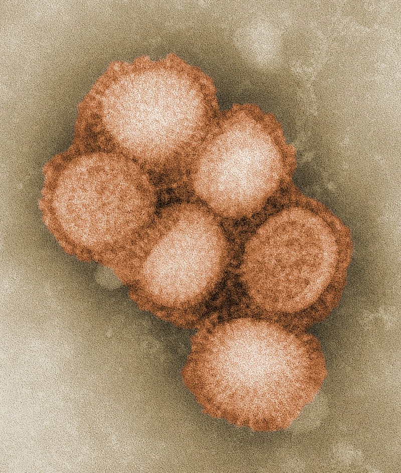 Illustration for article titled Psychedelic Images of Terrifying Viruses
